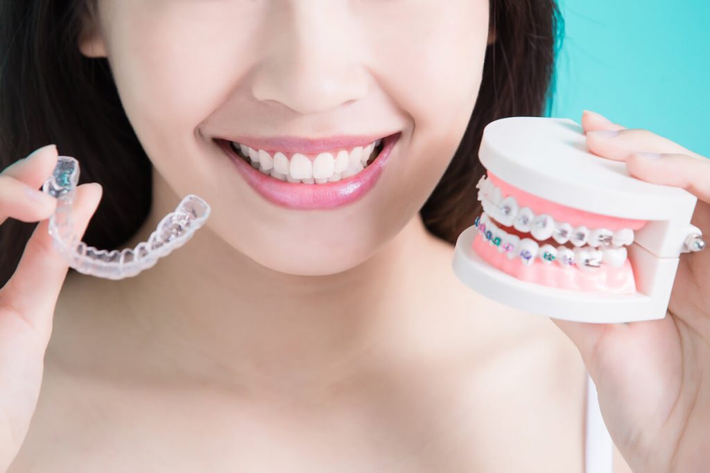 Teeth whitening cost in egypt